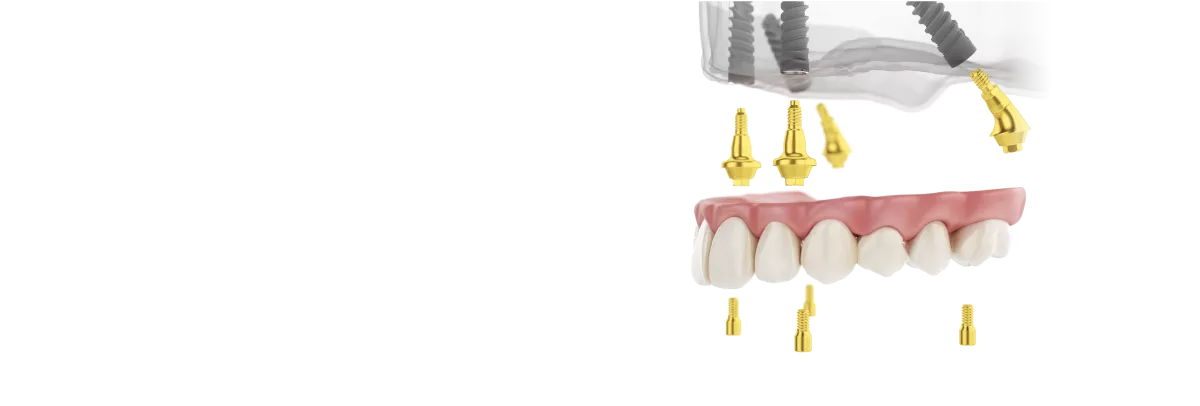 Screw-Retained-Conical-Narrow